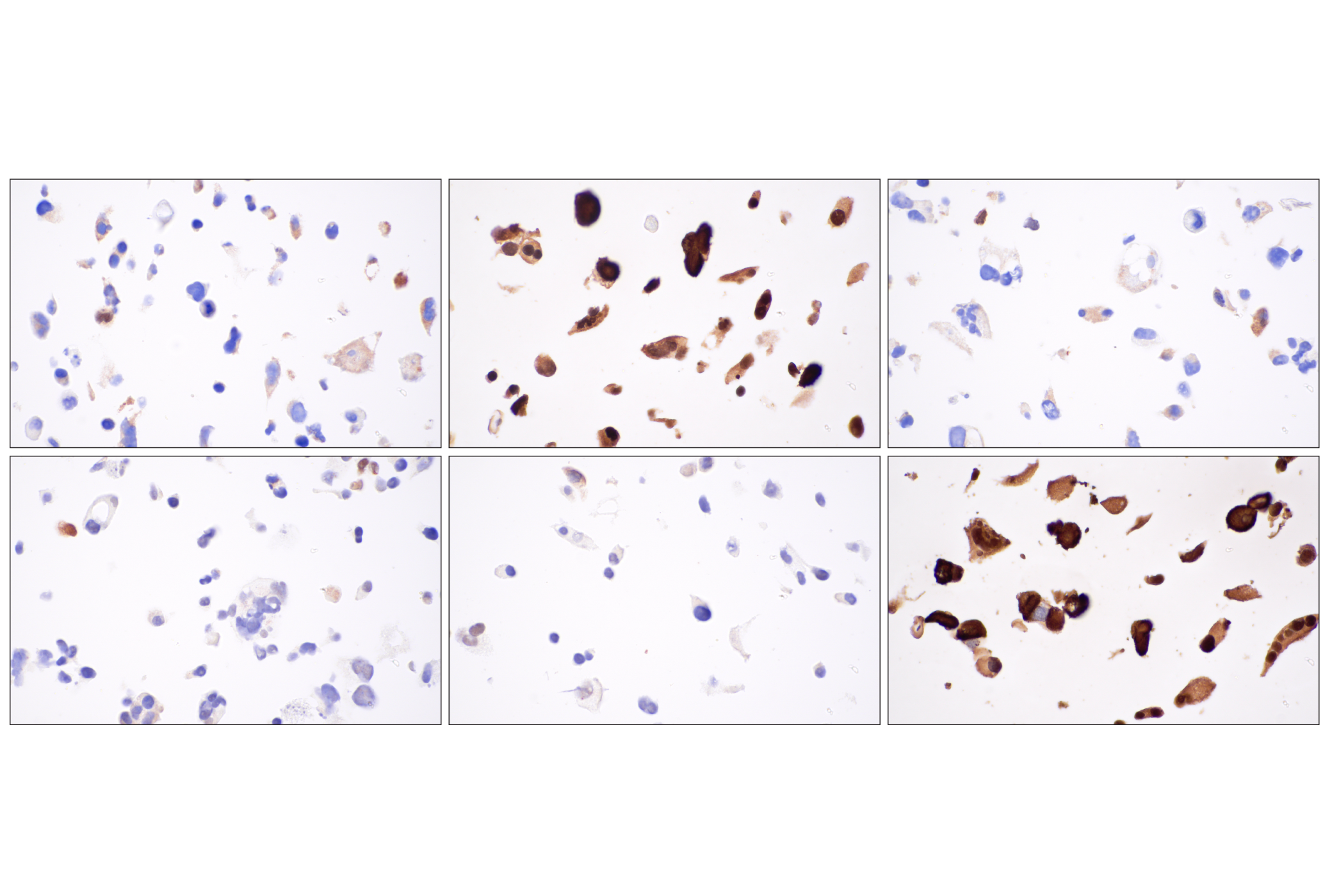 Hippo Pathway: Upstream Signaling Antibody Sampler Kit