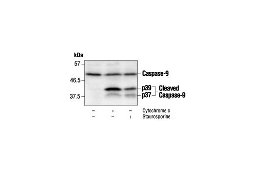 Apoptosis Antibody Sampler Kit (Mouse Preferred)