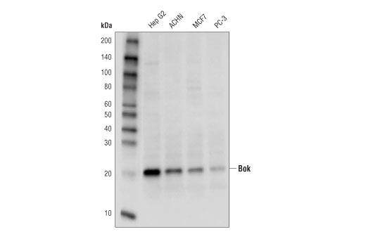 Pro-Apoptosis Bcl-2 Family Antibody Sampler Kit II