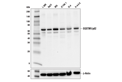 SQSTM1/p62 (D6M5X) Rabbit mAb