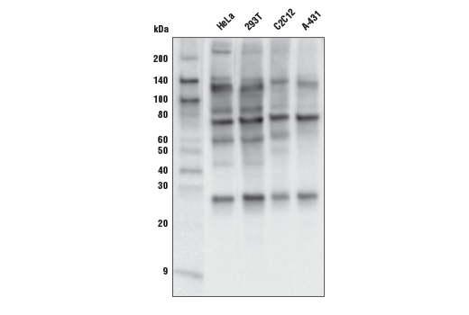 O-GlcNAc MultiMab™ Rabbit mAb mix