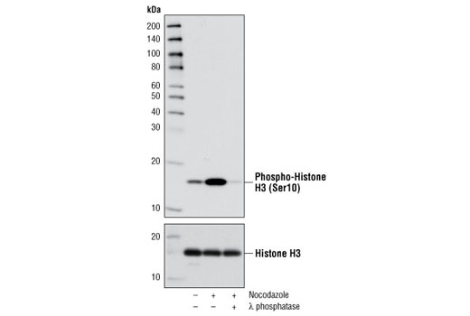 Phospho-Histone H3 (Ser10) (D2C8) XP ®  Rabbit mAb