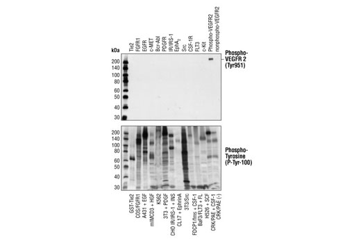 Phospho-VEGF Receptor 2 Antibody Sampler Kit