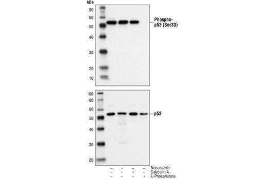 p53 Antibody Sampler Kit