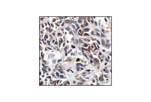 NF-kappaB Family Member Antibody Sampler Kit