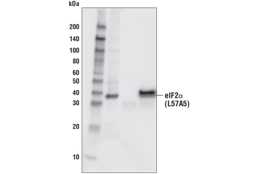 ER Stress-induced Autophagy Antibody Sampler Kit