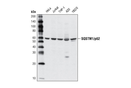 SQSTM1/p62 Antibody