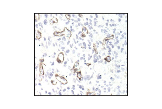 Cancer Associated Fibroblast Marker Antibody Sampler Kit