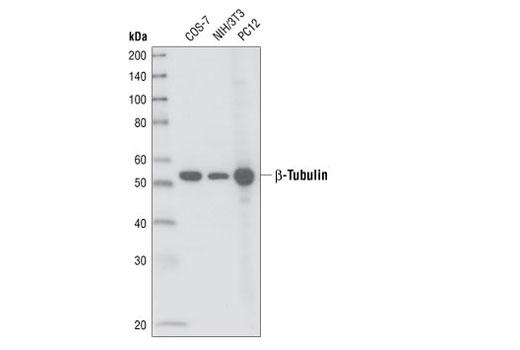 beta-Tubulin (9F3) Rabbit mAb