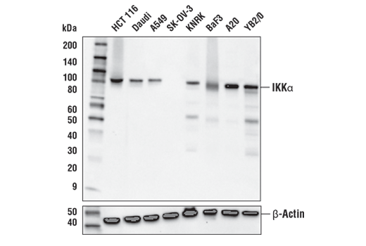 NF-kappaB Pathway Antibody Sampler Kit II