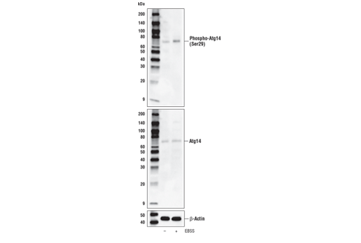 Phospho-Atg14 (Ser29) (D4B8M) Rabbit mAb