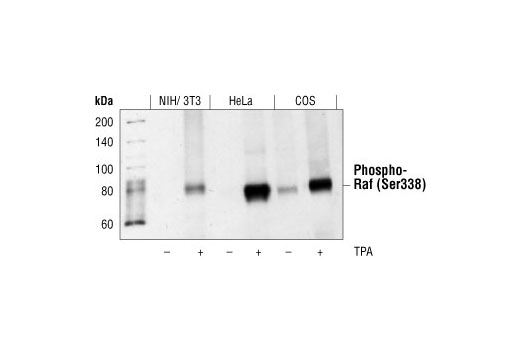 Phospho-Erk1/2 Pathway Antibody Sampler Kit