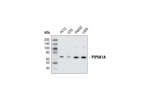 PIP5K1A Antibody
