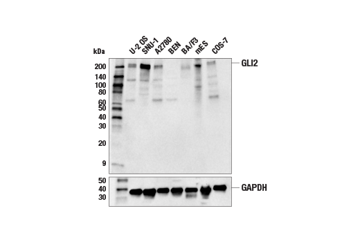 Hedgehog Signaling Antibody Sampler Kit