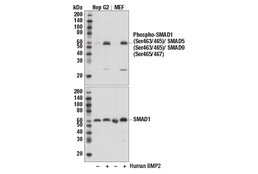 Phospho-SMAD1 (Ser463/465)/ SMAD5 (Ser463/465)/ SMAD9 (Ser465/467) (D5B10) Rabbit mAb