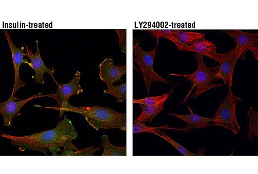 Phospho-Akt Pathway Antibody Sampler Kit