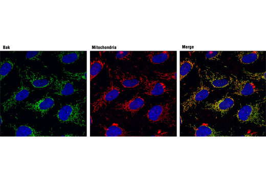 Pro-Apoptosis Bcl-2 Family Antibody Sampler Kit