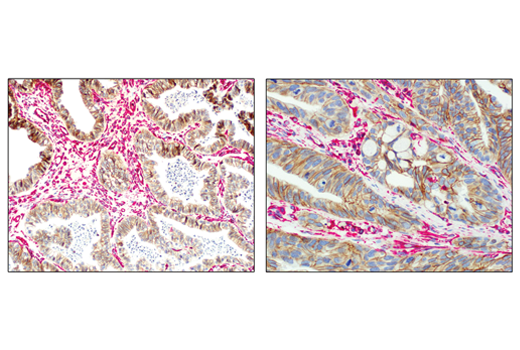 SignalStain ®  Boost IHC Detection Reagent (AP, Rabbit)