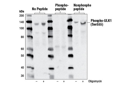 ULK1 Antibody Sampler Kit