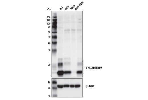 Hypoxia Pathway Antibody Sampler Kit