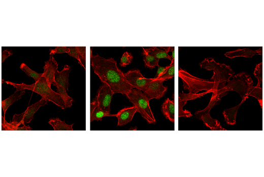 TGF-beta Fibrosis Pathway Antibody Sampler Kit