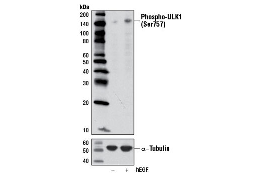 ULK1 Antibody Sampler Kit