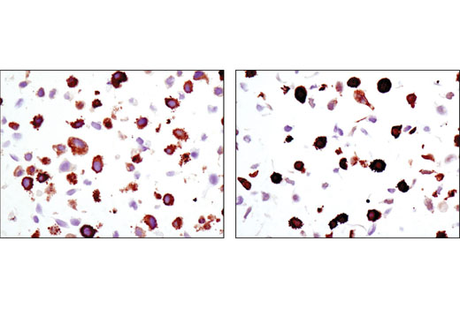 Phospho-p38 MAPK Pathway Antibody Sampler Kit