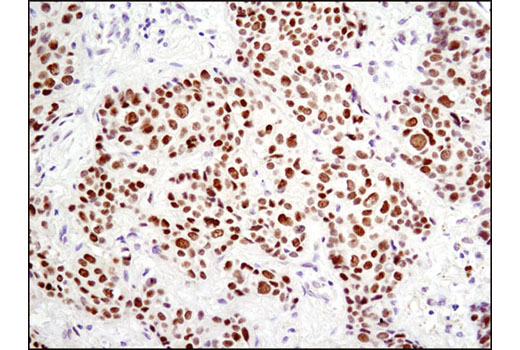 Notch Activated Targets Antibody Sampler Kit