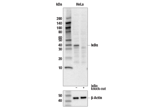 NF-kappaB Pathway Antibody Sampler Kit II