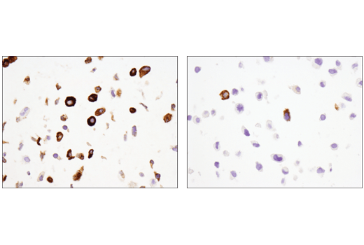 MUC5AC (E3O9I) XP ®  Rabbit mAb