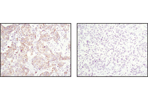 Pro-Apoptosis Bcl-2 Family Antibody Sampler Kit