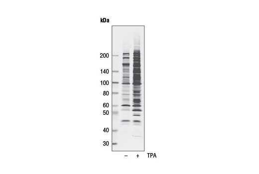 Phospho-PKC Substrate Motif [(R/K)XpSX(R/K)] MultiMab™ Rabbit mAb mix