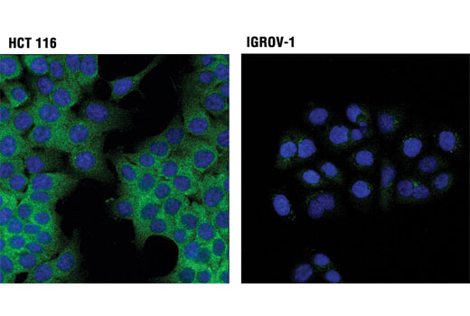 NF-kappaB Pathway Antibody Sampler Kit