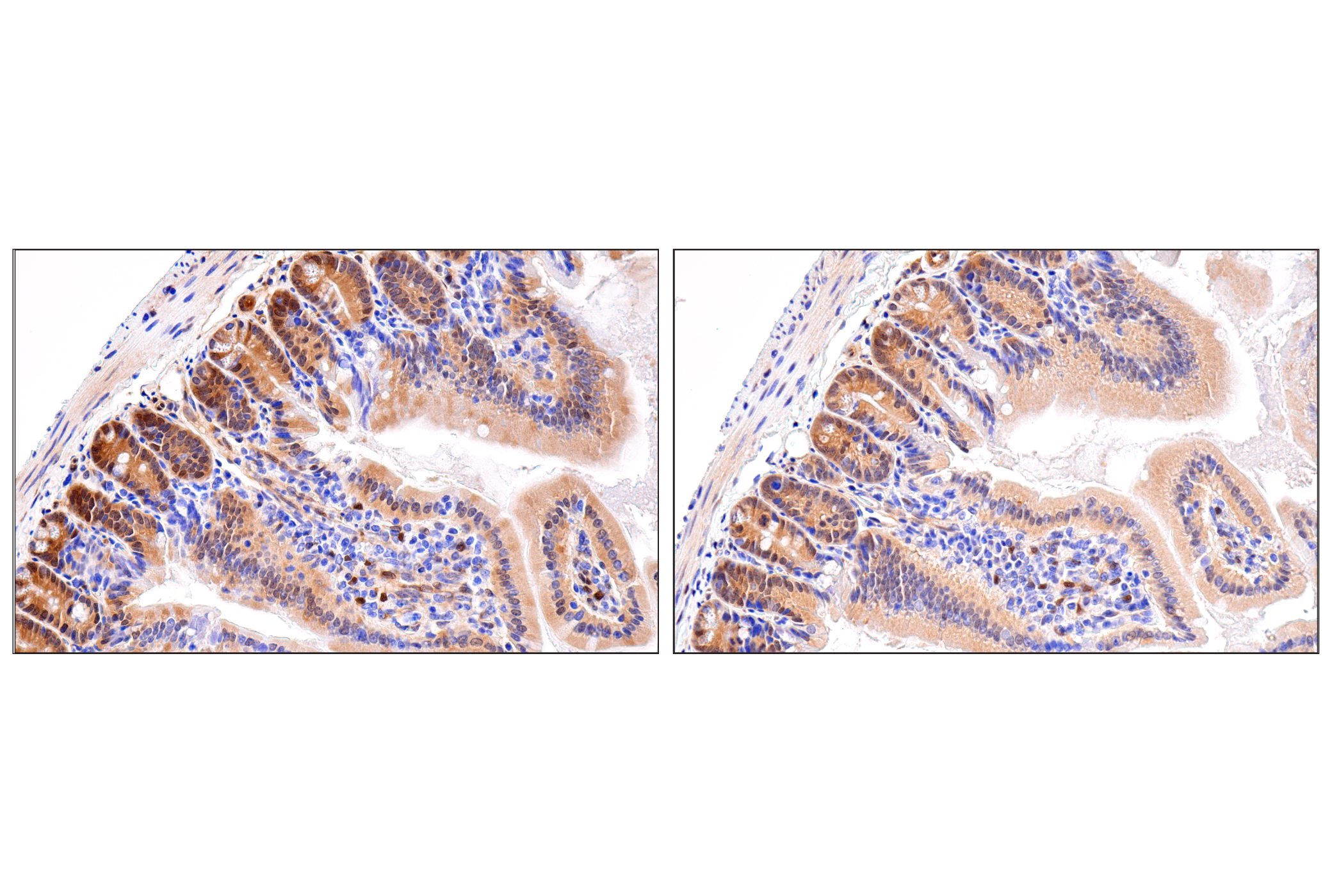 Hippo Pathway: Upstream Signaling Antibody Sampler Kit