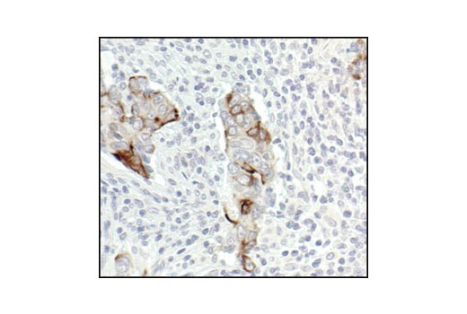 NF-kappaB Pathway Antibody Sampler Kit