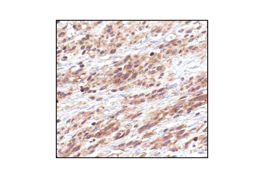 NF-kappaB Pathway Antibody Sampler Kit