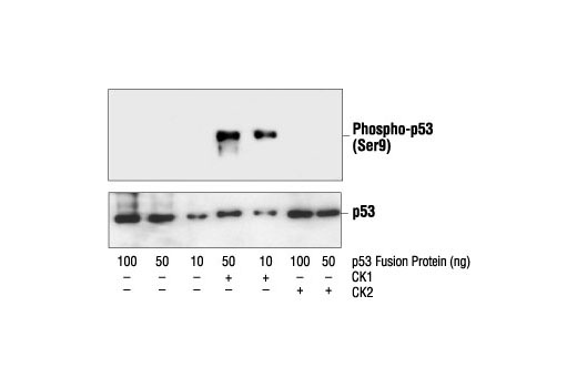 p53 Antibody Sampler Kit