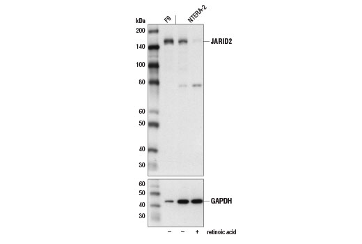 JARID2 (D6M9X) Rabbit mAb