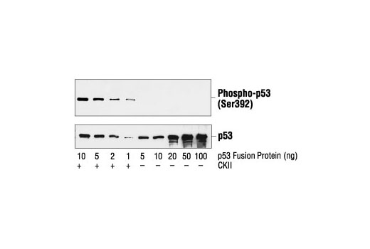 p53 Antibody Sampler Kit