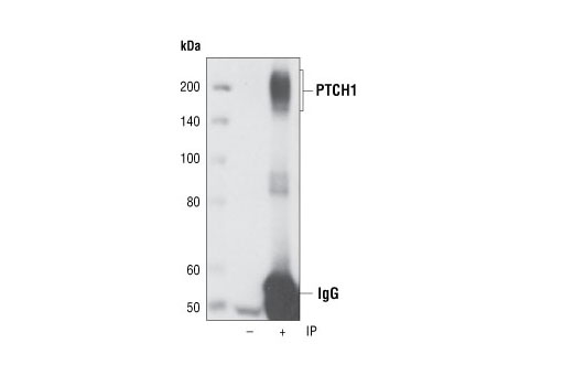 Hedgehog Signaling Antibody Sampler Kit