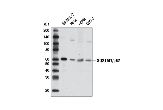 SQSTM1/p62 (D5E2) Rabbit mAb