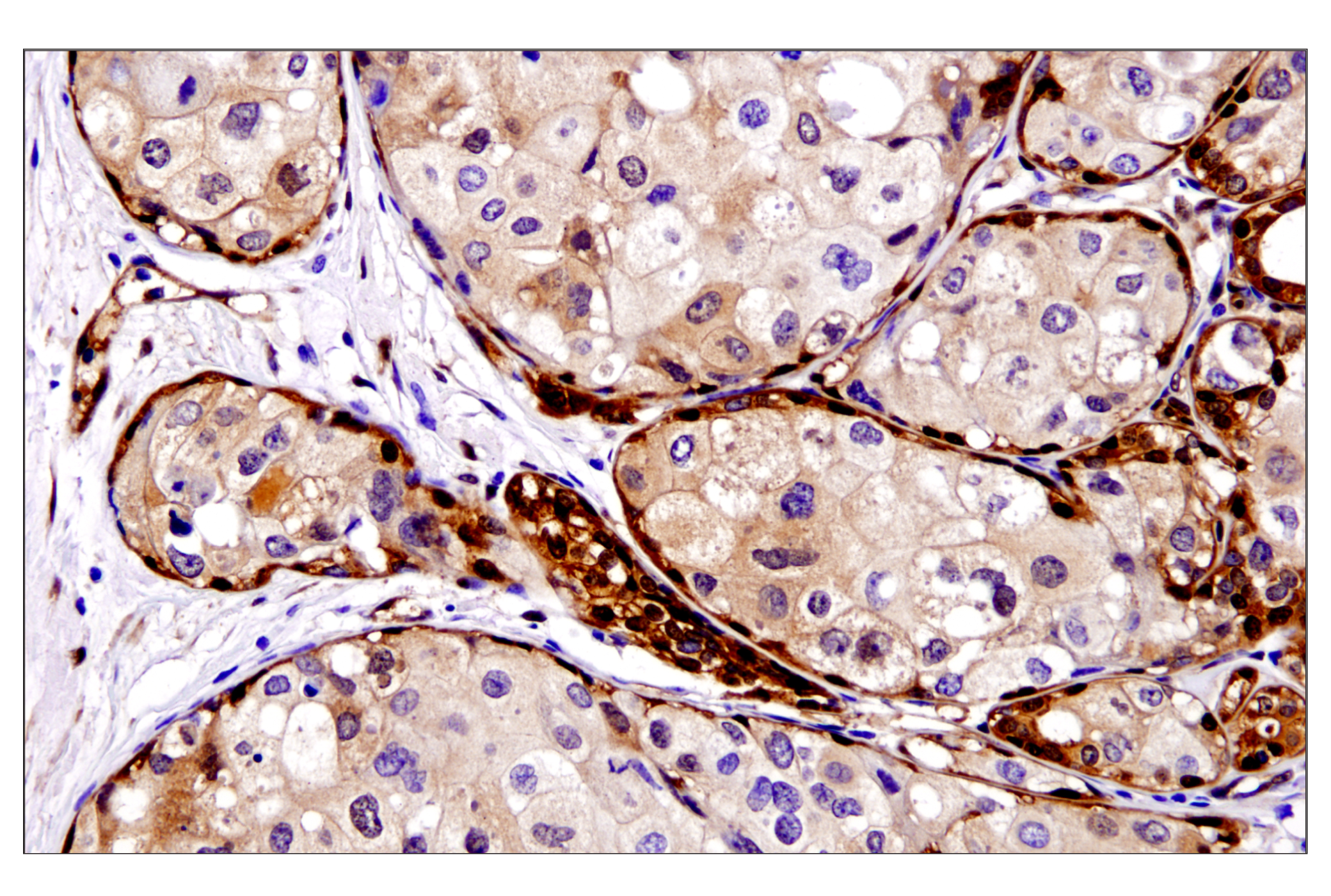 Hippo Pathway: Upstream Signaling Antibody Sampler Kit