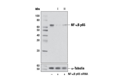 SignalSilence ®  NF-kappaB p65 siRNA I (Mouse Specific)