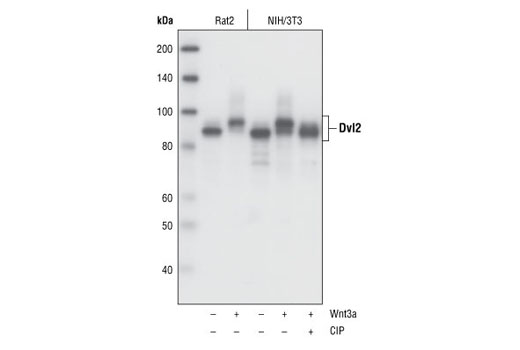 Wnt Signaling Antibody Sampler Kit