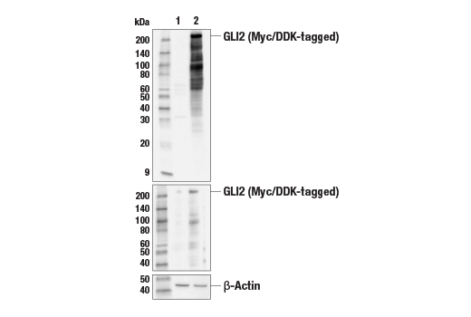 Hedgehog Signaling Antibody Sampler Kit
