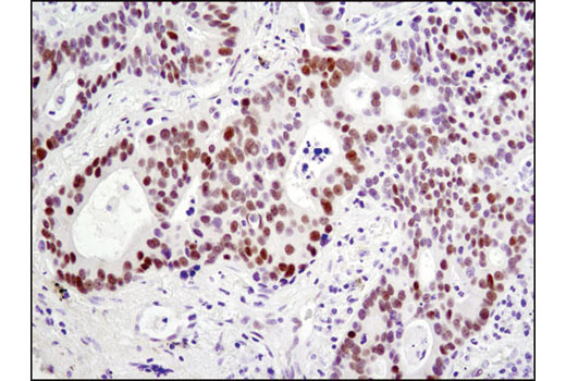 Notch Activated Targets Antibody Sampler Kit