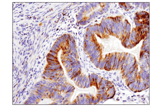 Pro-Apoptosis Bcl-2 Family Antibody Sampler Kit