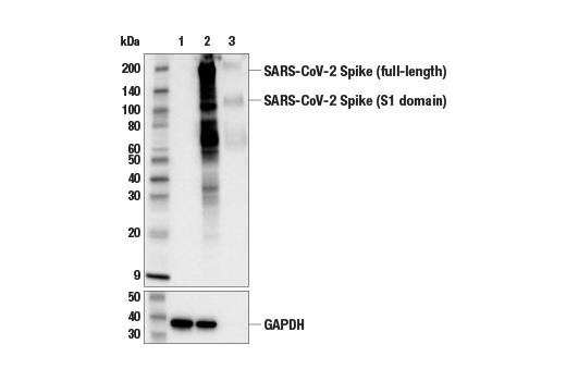 SARS-CoV-2 Spike Protein (S1) (E5S3V) Rabbit mAb