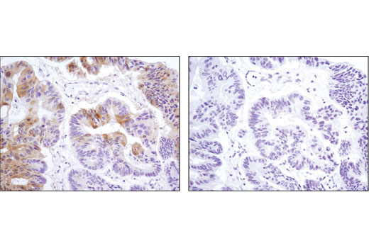 Phospho-Erk1/2 Pathway Antibody Sampler Kit