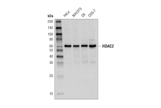 Class I HDAC Antibody Sampler Kit